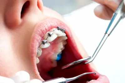 ORTOKLINIKA dr n.med. K.Jankowska spec.ortodoncji